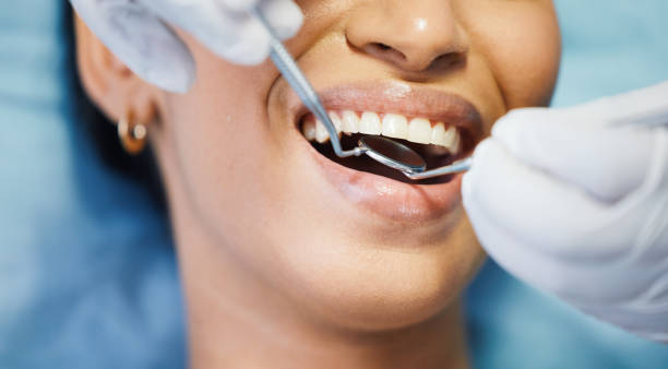 Best Chipped Tooth Repair Near Me  in North Caldwell, NJ