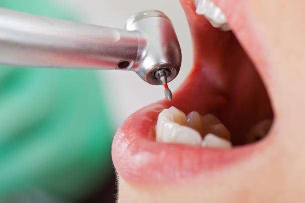 Best Knocked-Out Tooth Emergency  in North Caldwell, NJ
